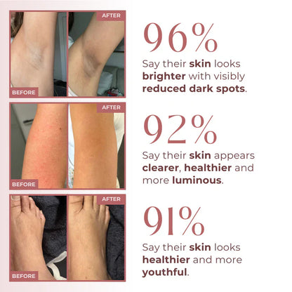 PEEL SHOT 99% Kojic Acid + Turmeric Body Exfoliating Spray