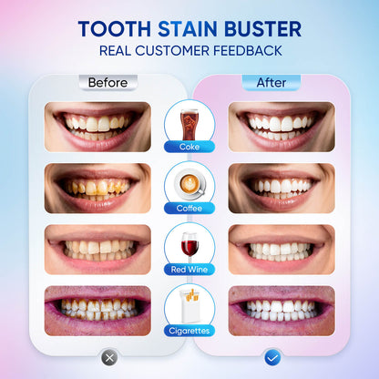 🦷Niacinamide whitening toothpaste: visibly whiter teeth in 7 days👄