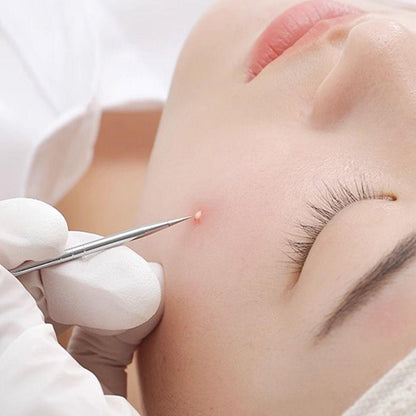 Professional Blackhead & Acne Extractor Kit