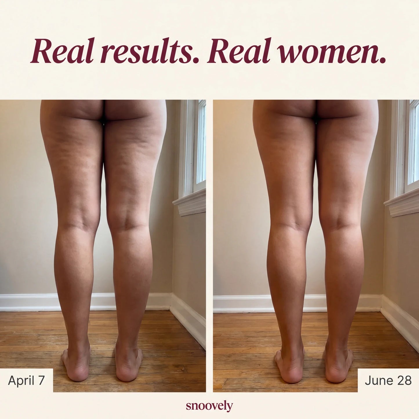 🍑Snoovely 3D Anti-Cellulite Leggings – Sculpt, Smooth & Shape with Every Step