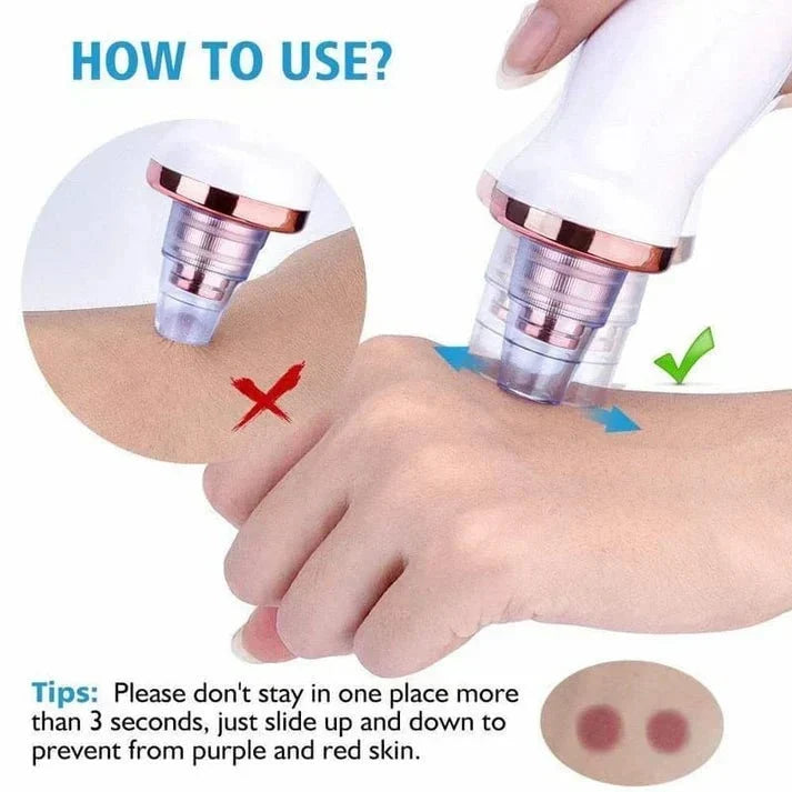Powerful Blackhead Removal Machine – Skin Care & Pore Cleaner