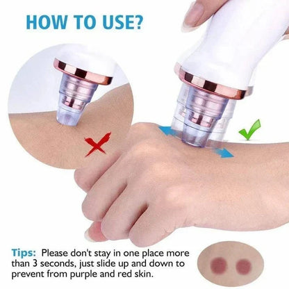 Powerful Blackhead Removal Machine – Skin Care & Pore Cleaner